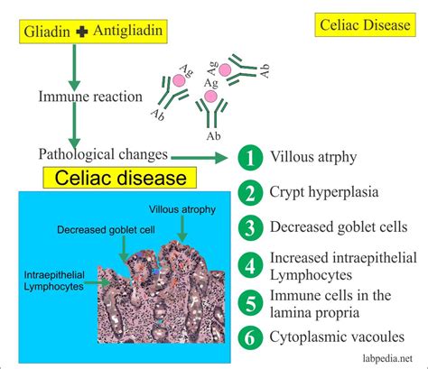 endomysial antibody iga negative